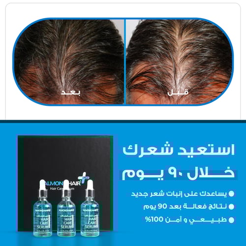 سيروم تحفيز نمو الشعر وتقليل التساقط (3 عبوات)