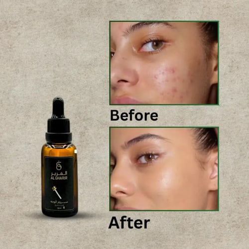 مجموعة التوفير الذهبية