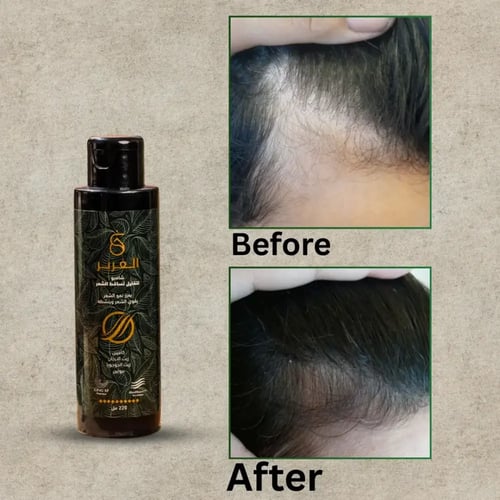 شامبو الغَرير الطبيعي لتقوية وتكثيف الشعر – عرض خا...