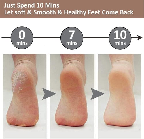 جهاز صنفرة كهربائي للقدم وقابل للشحن