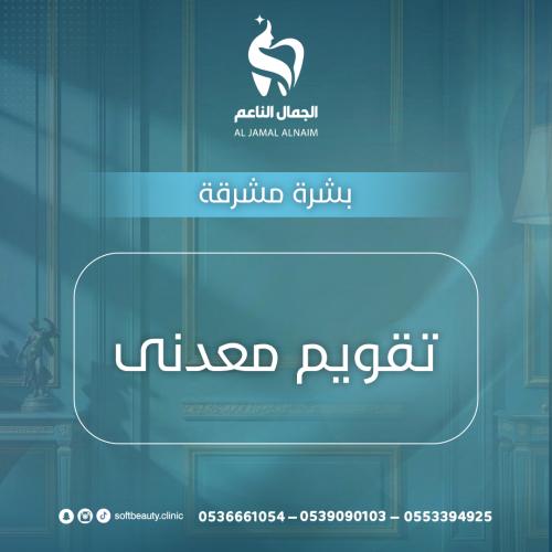 تقويم معدنى