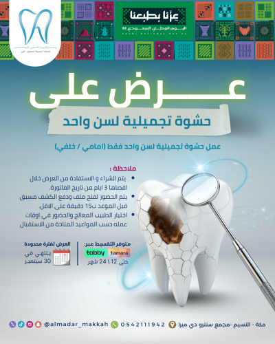 حشوة كومبوزيت تجميلية لسن واحد (خلفي أو امامي)