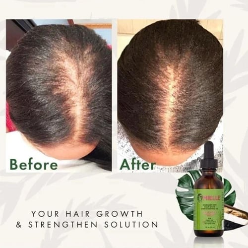 ميلي - زيت تقوية فروة الرأس والشعر، إكليل الجبل با...