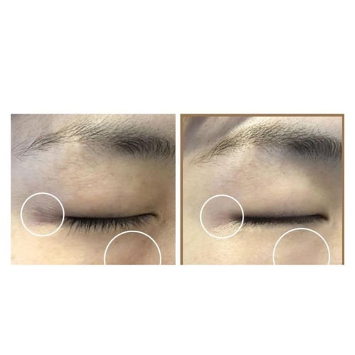 سوم باي مي - تونر فيتامين سي النقي