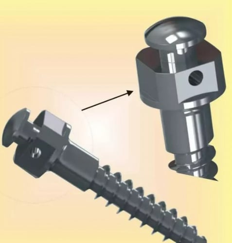 Titanium Alloy Microimplant