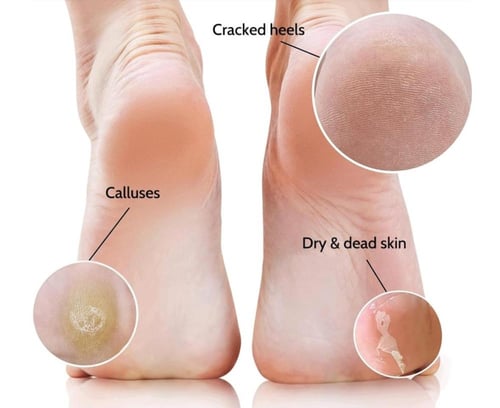 ملح الهملايا بالافندر للقدمين