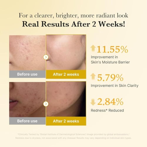 سيروم كوجيك أسيد والكركم مع نياسيناميد من ميديكوب...