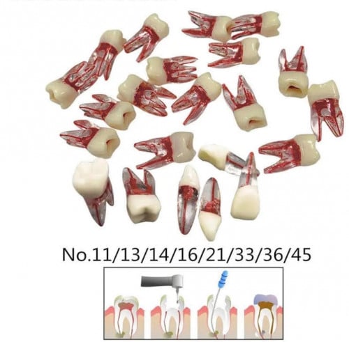 Transparent root canal teeth Different Size