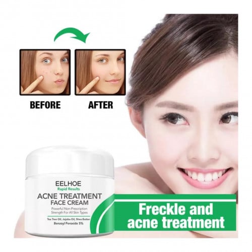 كريم معالجة حب الشباب