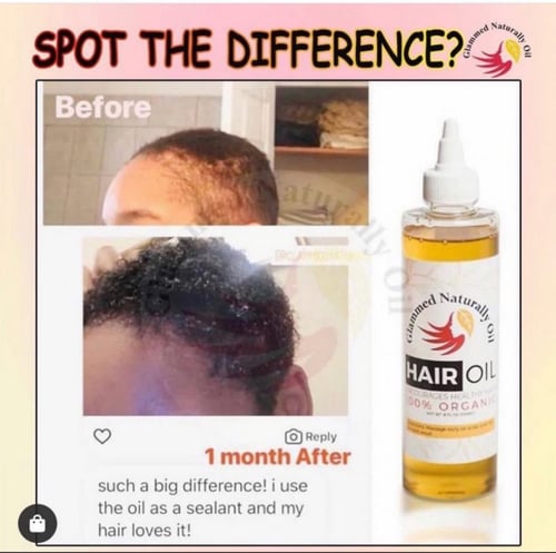 زيت التألق لتحفيز وتطويل الشعر والقضاء ع الفراغات...