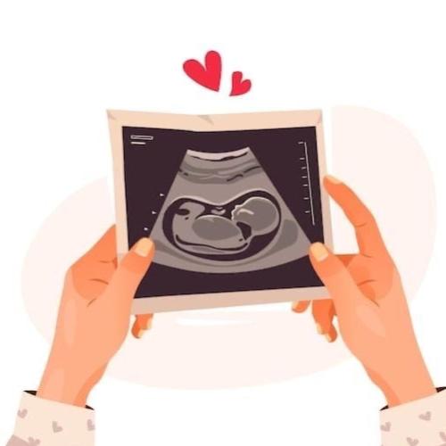 برنامج ( أقرب مما أظن ) - تهيئة الحمل _