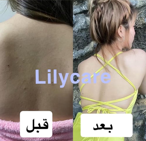 صابونة شوكو بار اليومي من ساتيدا Choco Bar Soap Ev...