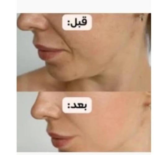 زيت زهرة الفولين الياباني - 100 مل