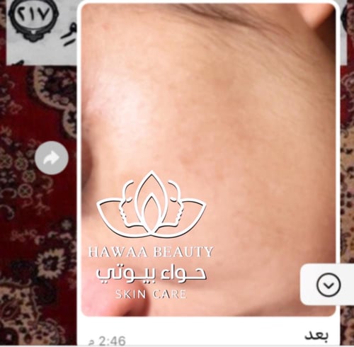 مجموعة النضارة المكثفة للوجه (ثنائي الإشراق)