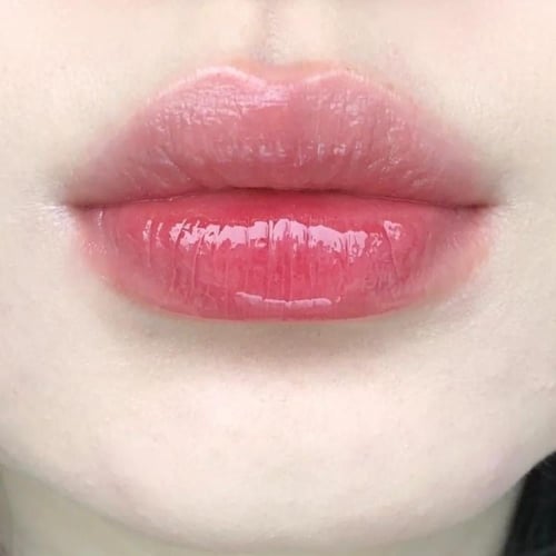 مجموعة توريد الشفاه