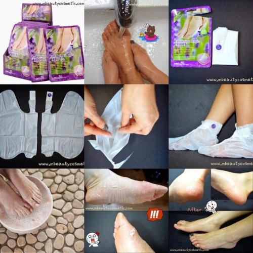 الجوارب السحرية لتقشيرالقدم