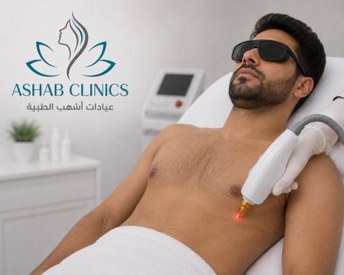1جلسة ليزر ميني بدي (سبلندر اكس أو الديكا اقين)