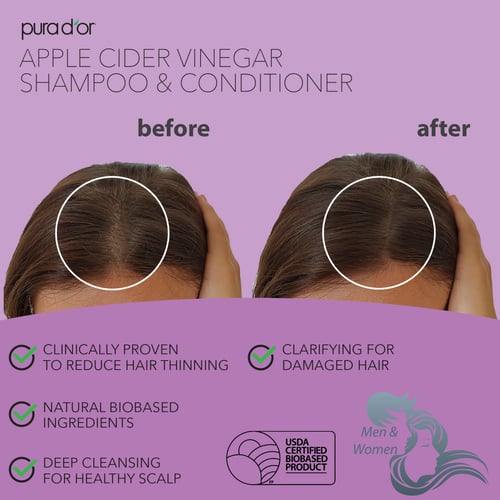 شامبو وبلسم خل التفاح PURA D'OR بورا دور