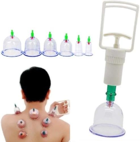 طقم 6 كاسات حجامة