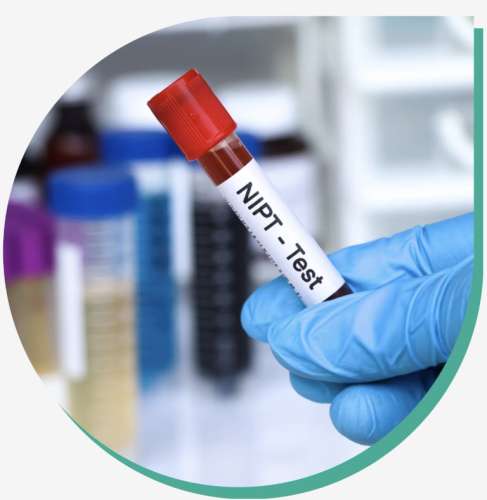 الفحص الاستطلاعي NIPT