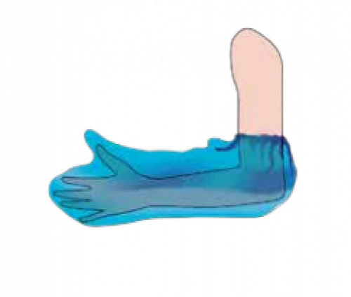 حامى لجبيرة ذراع 9301