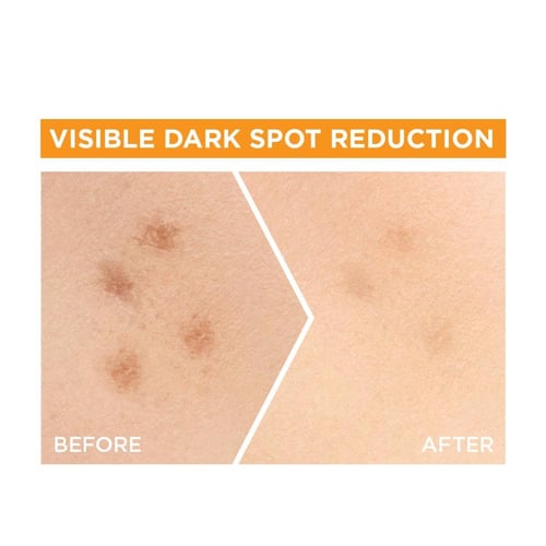 جارنييه سكين اكتيف سيروم فيتامين سي لإشراقة سريعة...