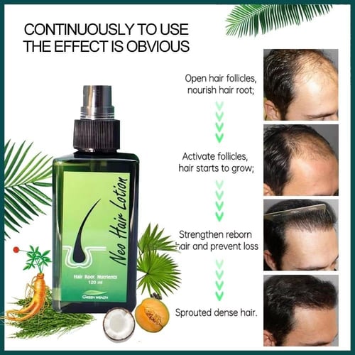 Neo Hair Lotion نيو هير لوشن
