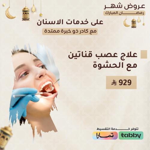 علاج عصب قناتين مع الحشوة