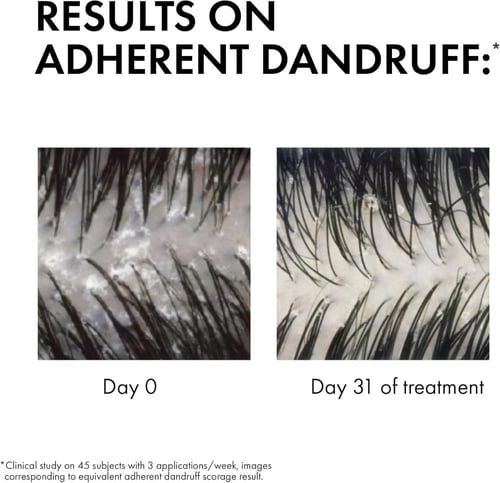 فيشي ديركوس شامبو ضد للقشرة للعناية بالشعر الجاف 3...