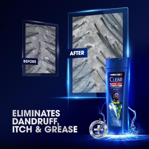 كلير شامبو فيني جونيور للرجال ضد القشرة ترطيب فائق...