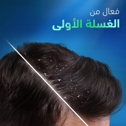 هيد اند شولدرز شامبو لفروة الرأس شديدة الحكة 400 م...