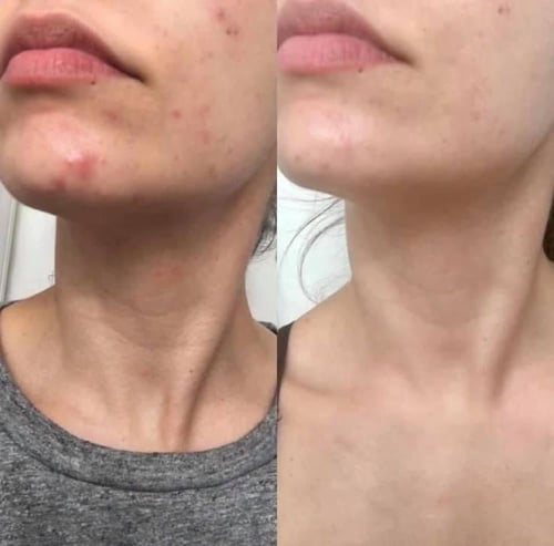 سيروم الشد نمبزن رقم 9 بيو ليفتنج 50مل