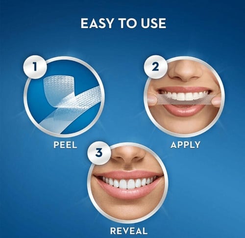 لصقات تبييض الأسنان ثلاثية الأبعاد في ساعة واحدة م...