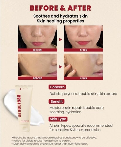 كريم بمستخلص الحلزون و الأرز 93% من سيكريت سيول 10...