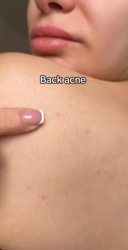 مجموعة التصبغات وجلد الدجاجة والترطيب