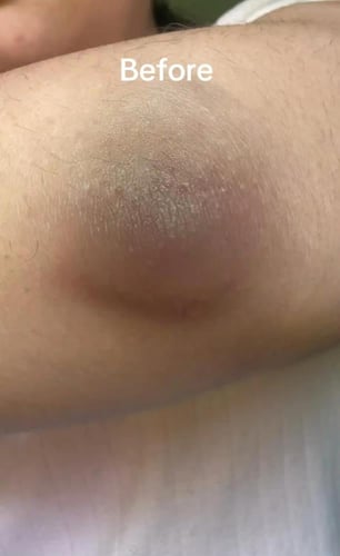 مجموعة التصبغات وجلد الدجاجة والترطيب