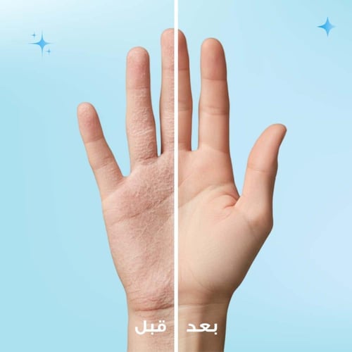 كي بي بلس كريم مرطب البشرة 75 مل