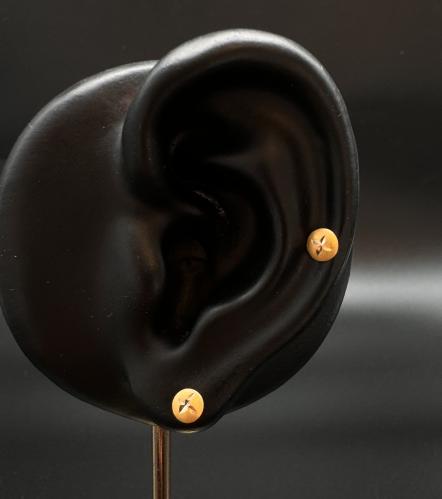 حلق اطفال
