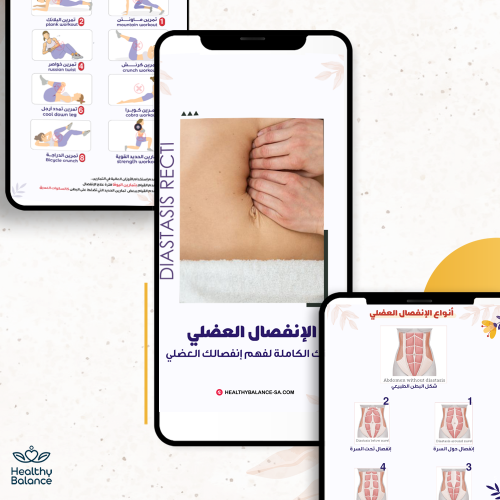 ملف الإنفصال العضلي