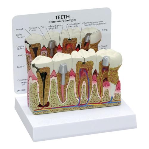 Teeth Model