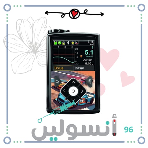 ستكر مضخة مدترونك امامي