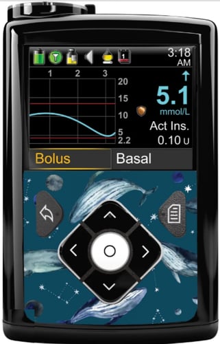 ستكر مضخة مدترونك