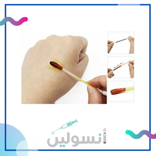 مسحات اليود