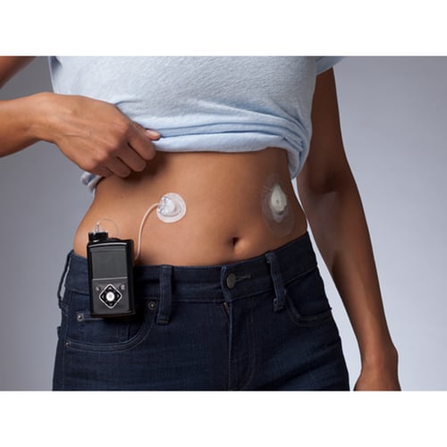 ميني ميد ميو ادفانس 6ملم