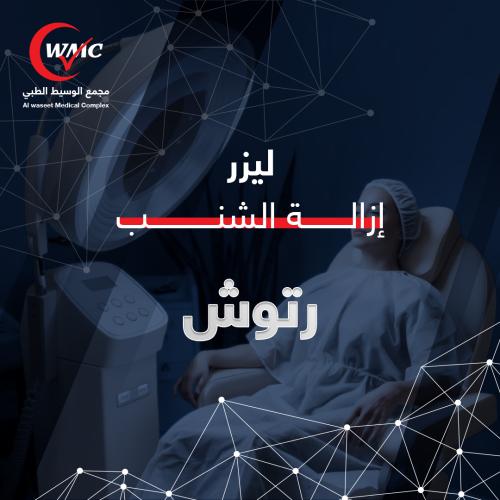 ليزر ازالة الشنب + الرتوش