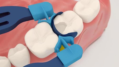 myClip 2.0 polydentia