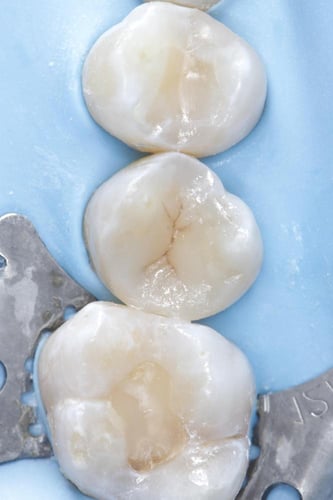 كاميرا كانون DSLR 650D مستعملة مع العدسة والاضاءة