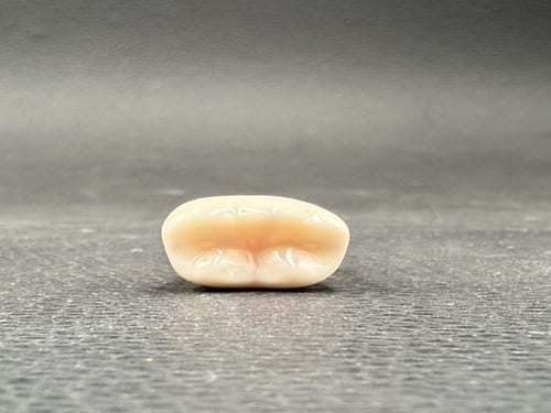 Endo molar access cavity