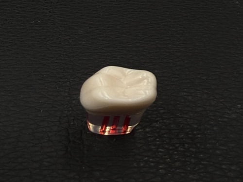 Endo molar access cavity
