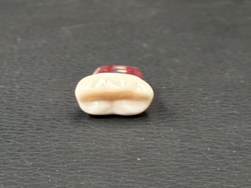 Endo molar access cavity